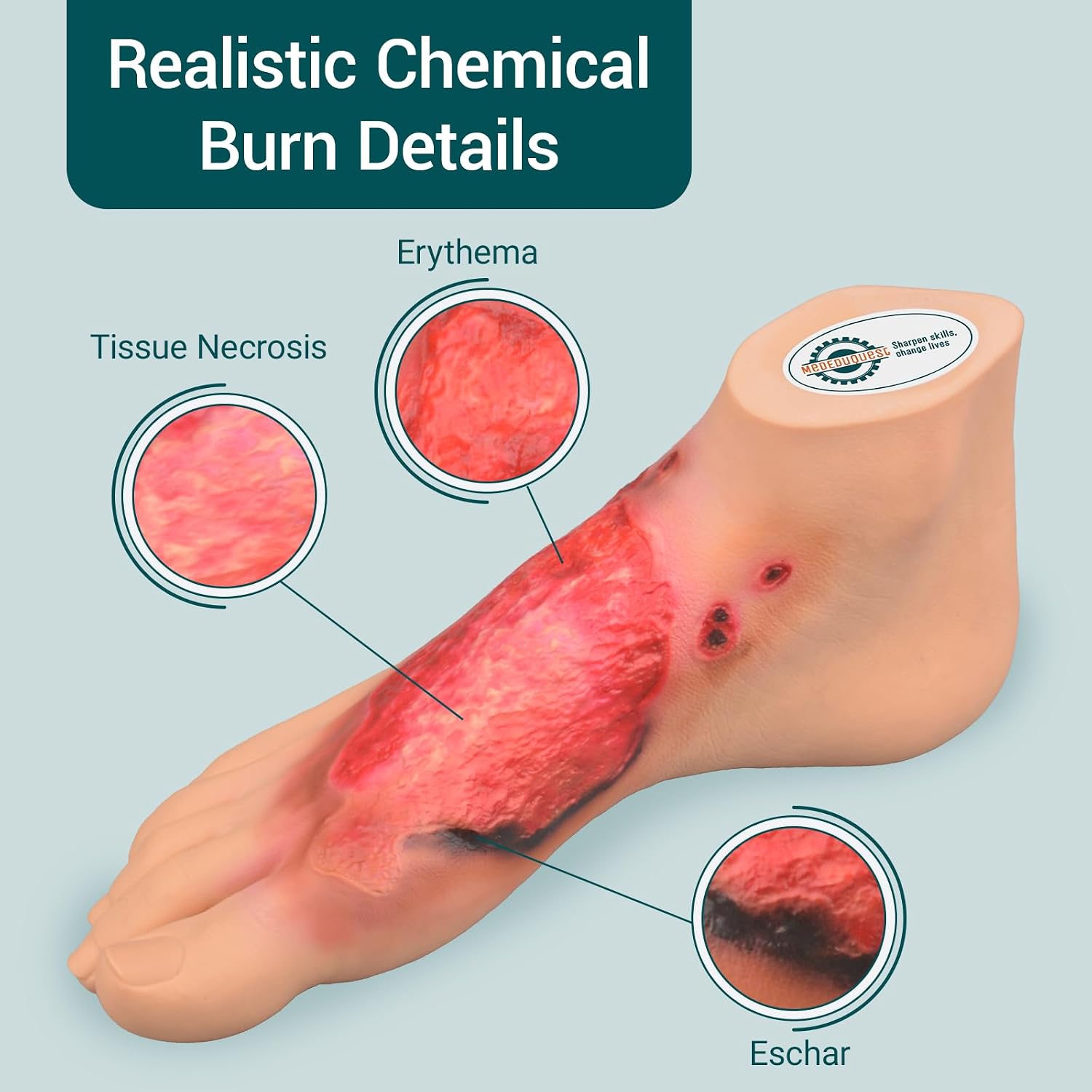 Chemical Burn Foot Demonstration Model