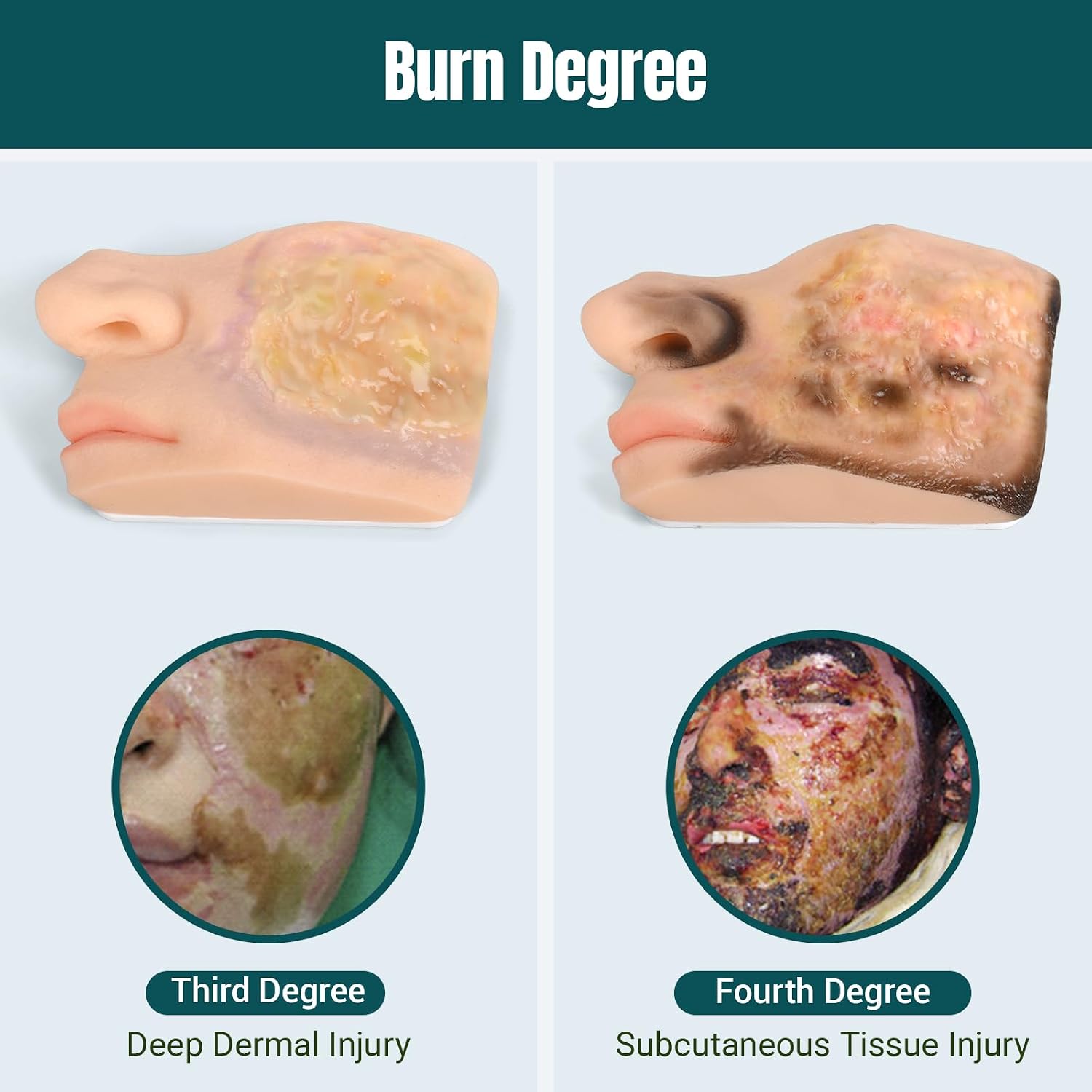 Chemical Facial Burn Models with Progressive Tissue Damage