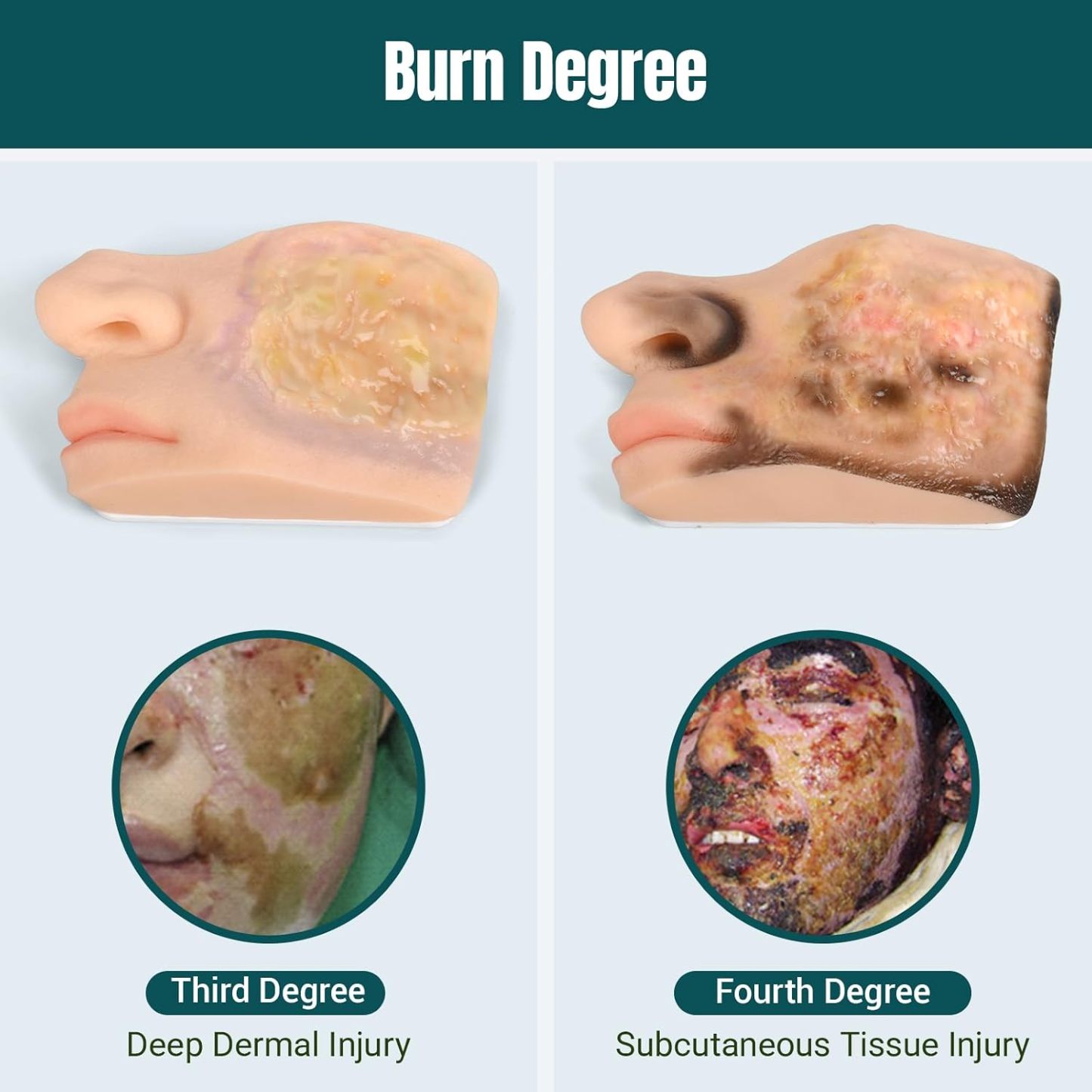 Chemical Facial Burn Models with Progressive Tissue Damage