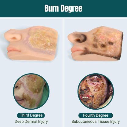 Chemical Facial Burn Models with Progressive Tissue Damage