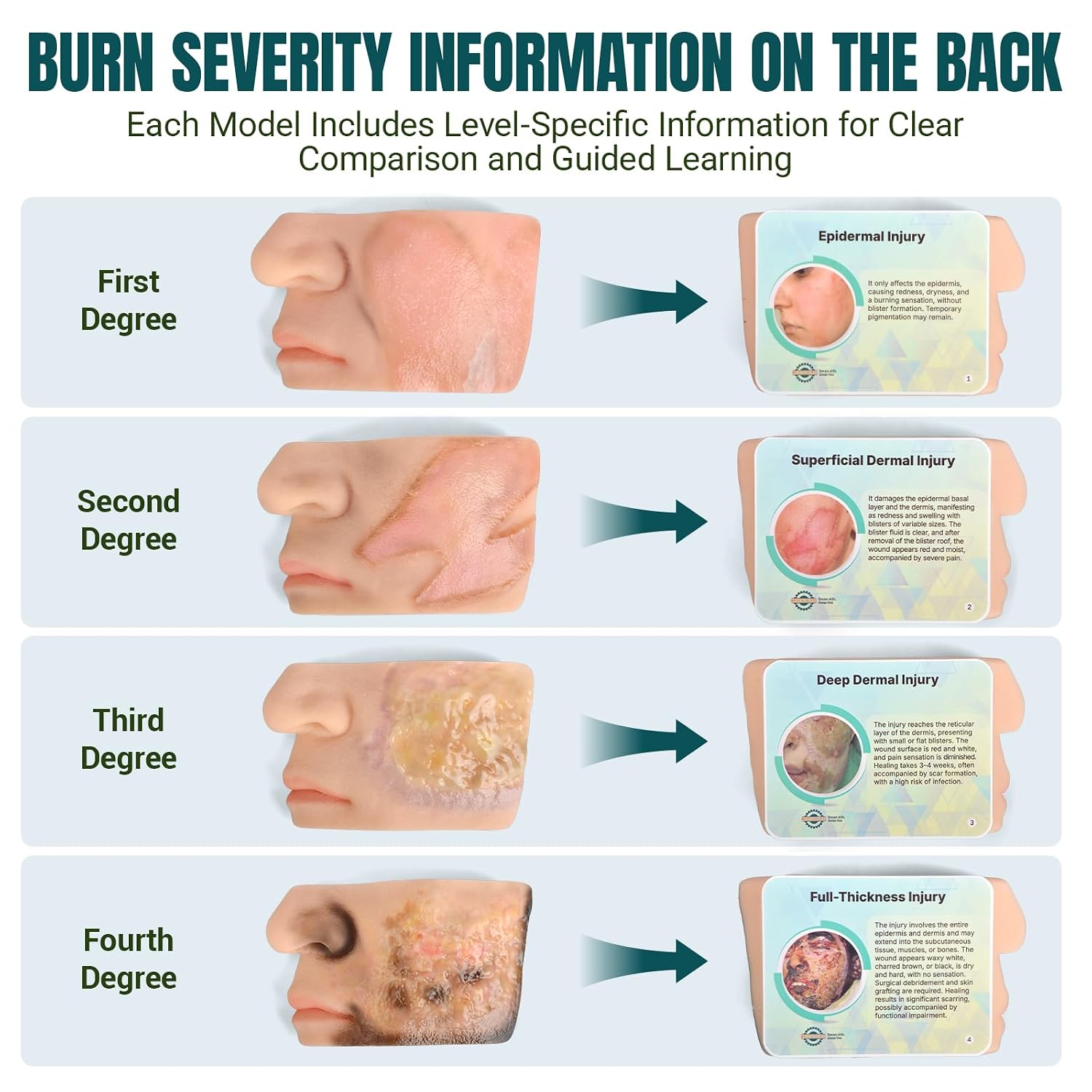 Chemical Facial Burn Wound Models with Educational Labels