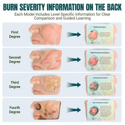 Chemical Facial Burn Wound Models with Educational Labels