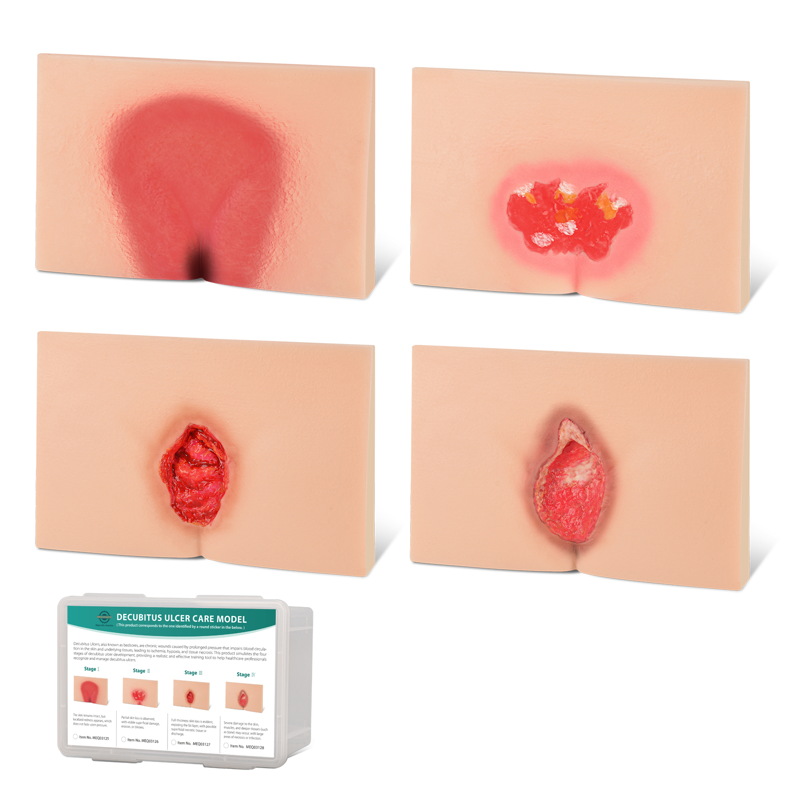 MedEduQuest Decubitus Ulcer Wound Care Model, Stage 1 to 4