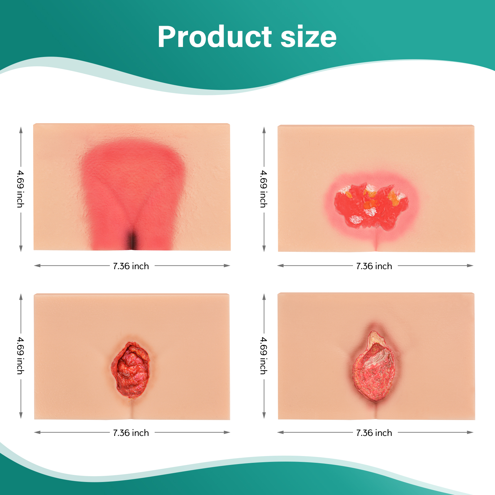 Decubitus Ulcer Wound Care Models, Stages 1 to 4