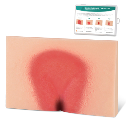 MedEduQuest Decubitus Ulcer Wound Care Model, Stage 1 to 4