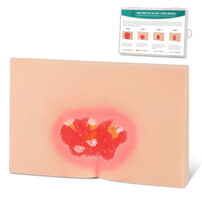 MedEduQuest Decubitus Ulcer Wound Care Model, Stage 1 to 4