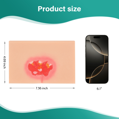 MedEduQuest Decubitus Ulcer Wound Care Model, Stage 1 to 4