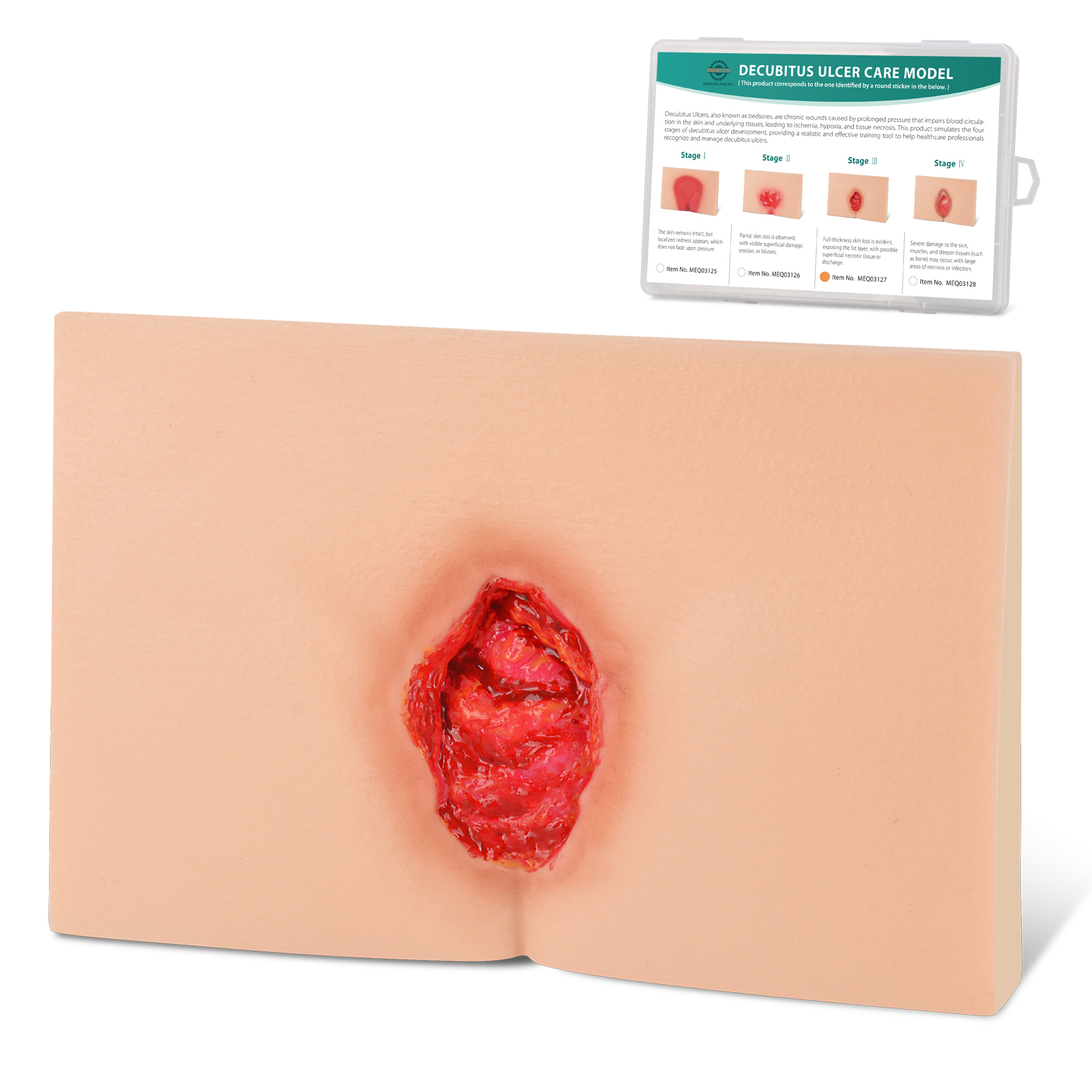 MedEduQuest Decubitus Ulcer Wound Care Model, Stage 1 to 4
