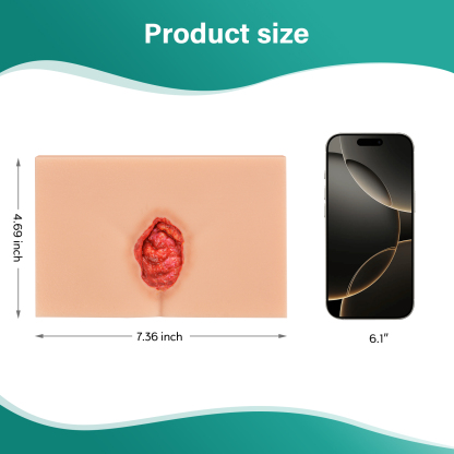 MedEduQuest Decubitus Ulcer Wound Care Model, Stage 1 to 4