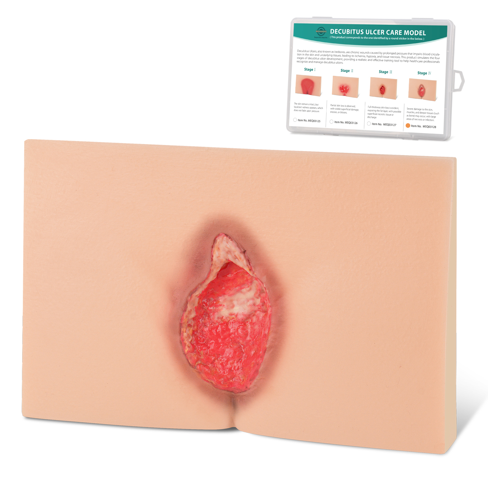 MedEduQuest Decubitus Ulcer Wound Care Model, Stage 1 to 4