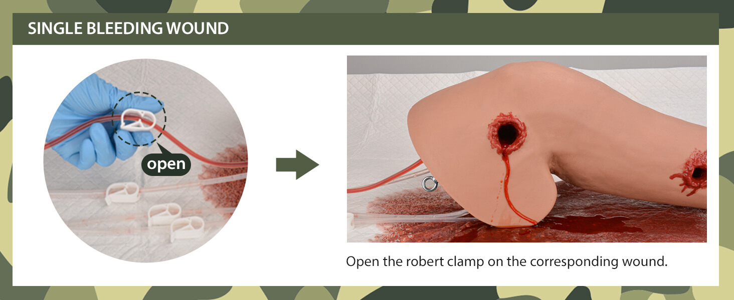 Wearable Wound Arm with Single Bleeding Wounds