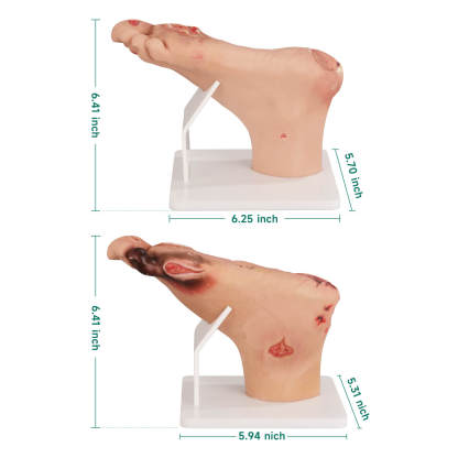 Diabetic Foot Model Size