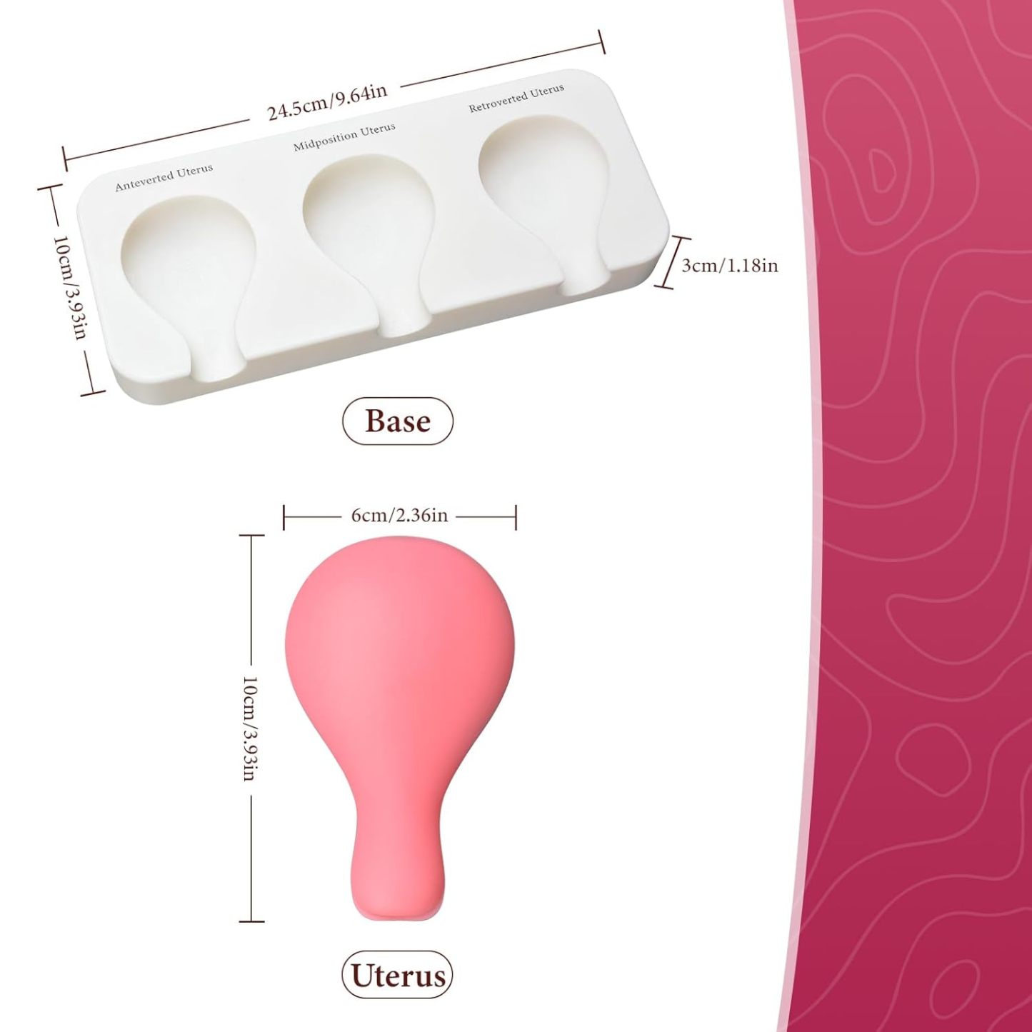 Dilatation and Curettage (D&C) Uterus Model