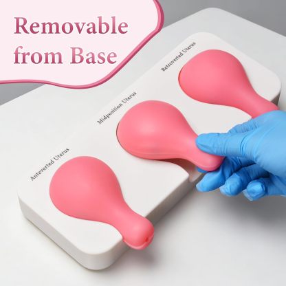 Dilatation and Curettage (D&C) Uterus Model