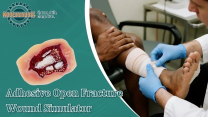 Adhesive Open Leg Fracture Wound Model