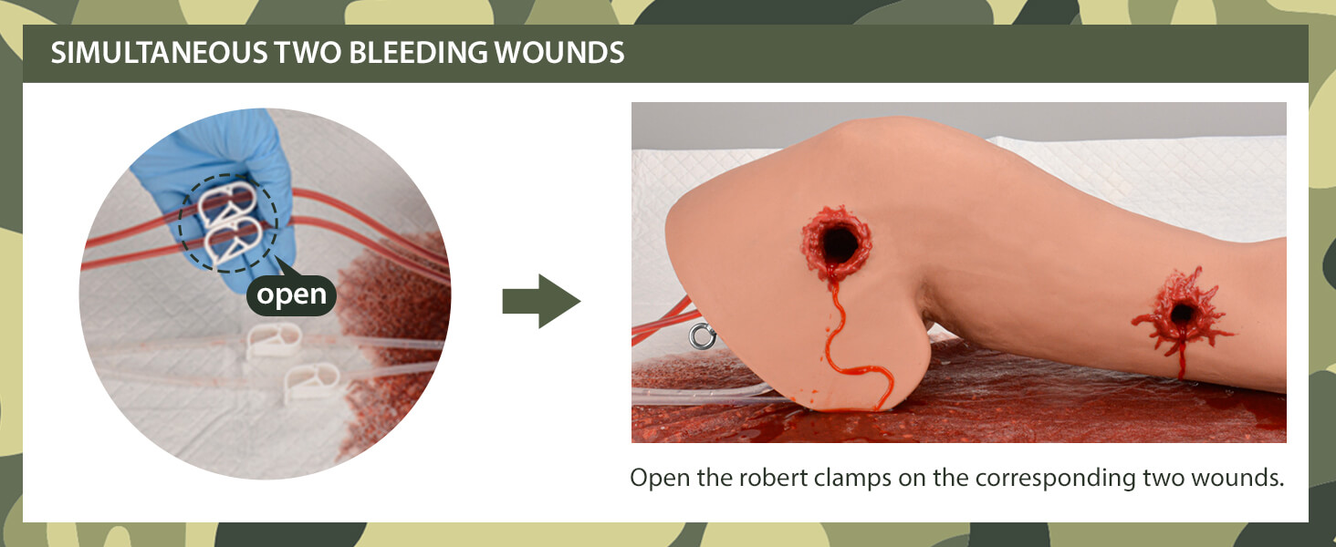 Wearable Hemorrhage Control Arm with Simultaneous Two Bleeding Wounds