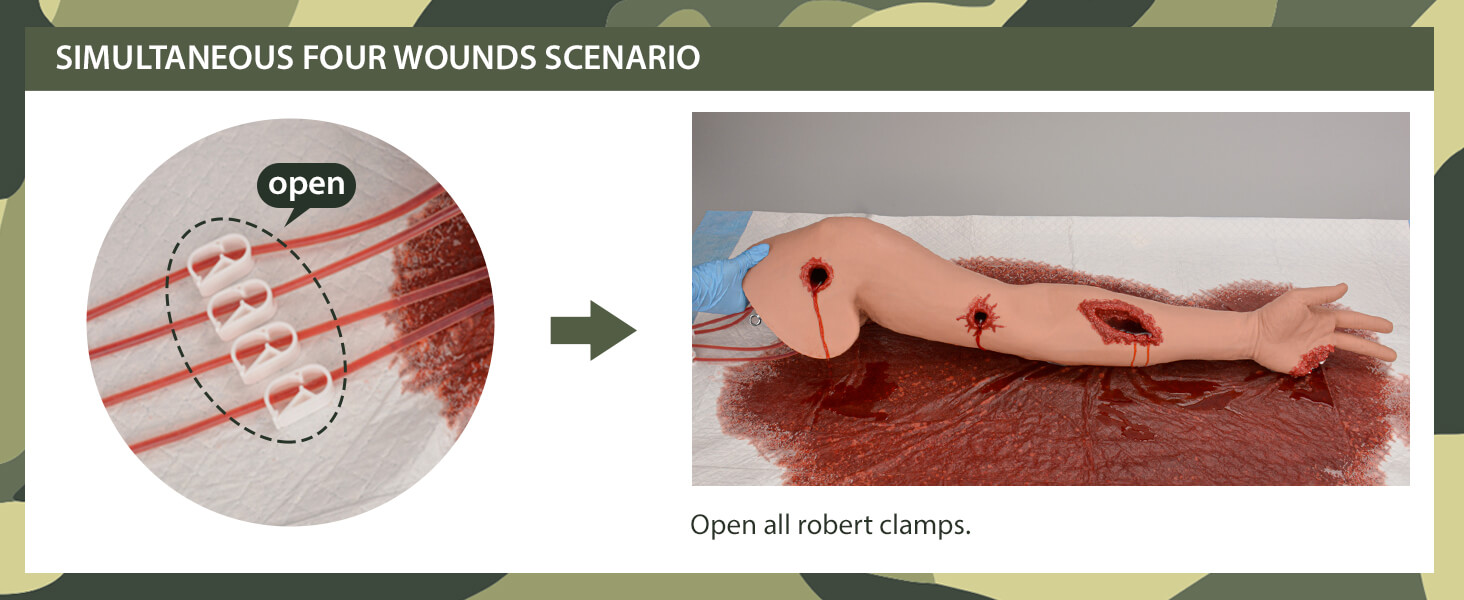Wearable Hemorrhage Control Arm with Simultaneous Four Bleeding Wounds