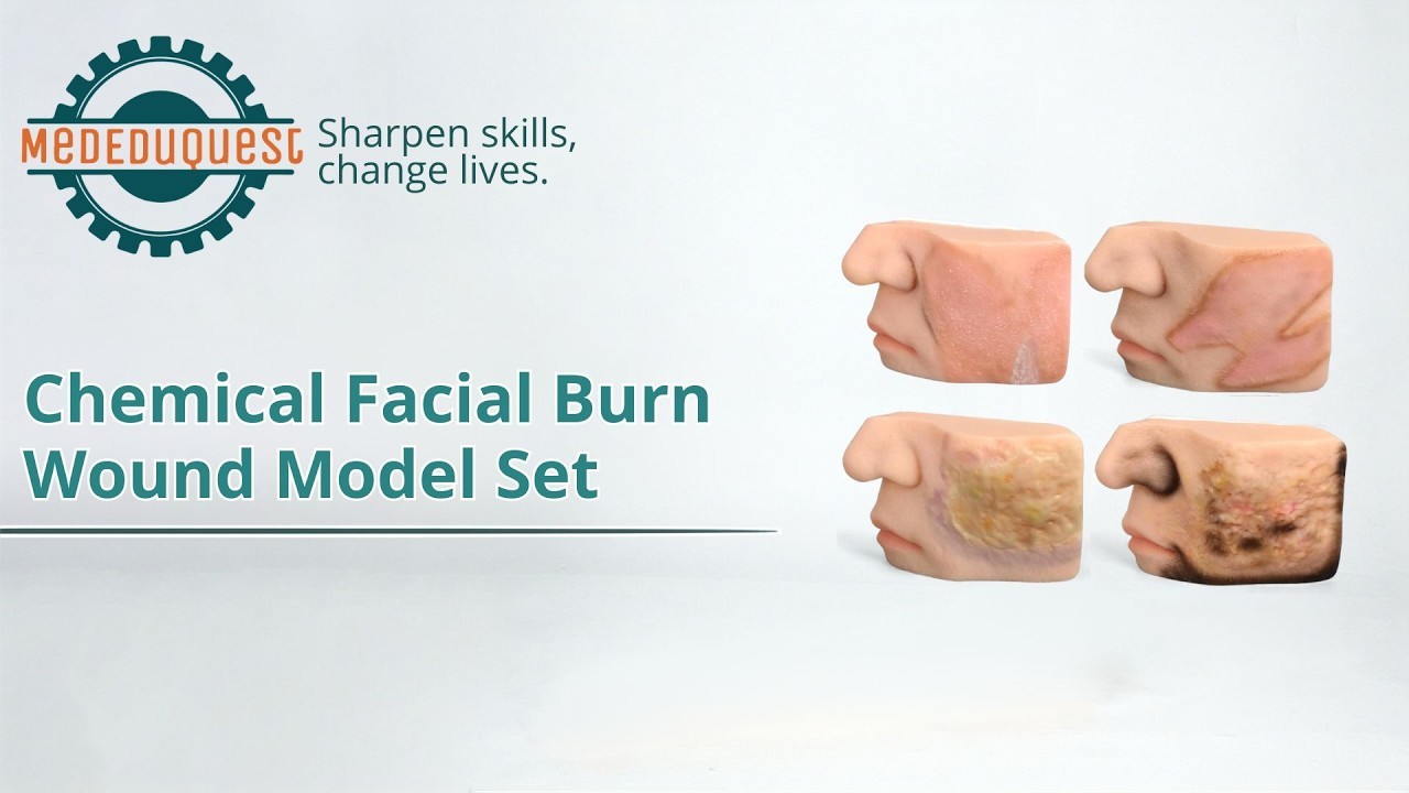 Chemical Facial Burn Wound Model Set (4-Piece)