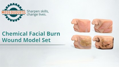Chemical Facial Burn Wound Model Set (4-Piece)
