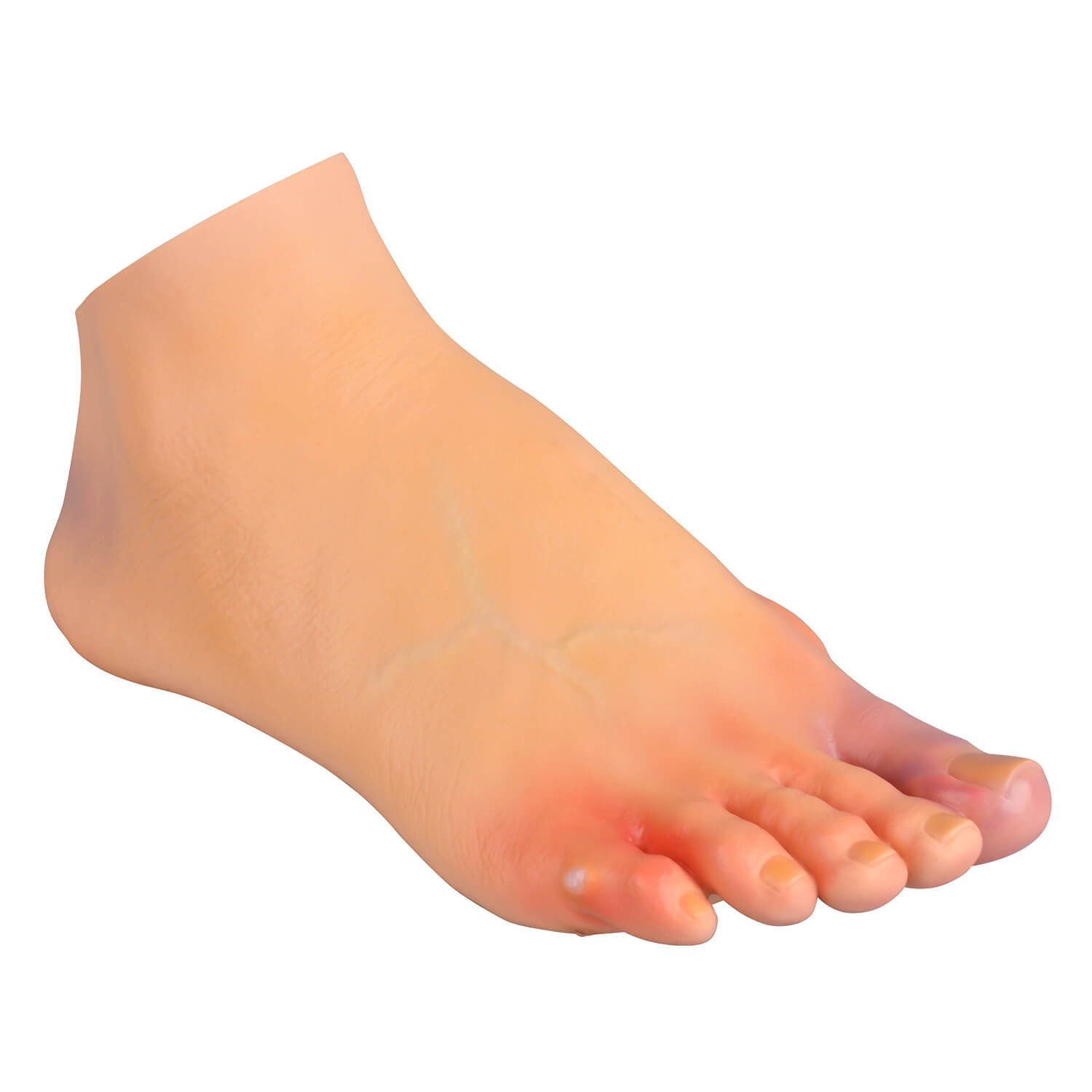 Foot Conditions Patient Education Model