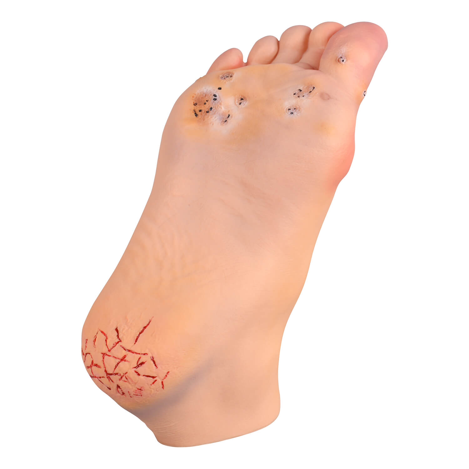 Foot Conditions Patient Education Model