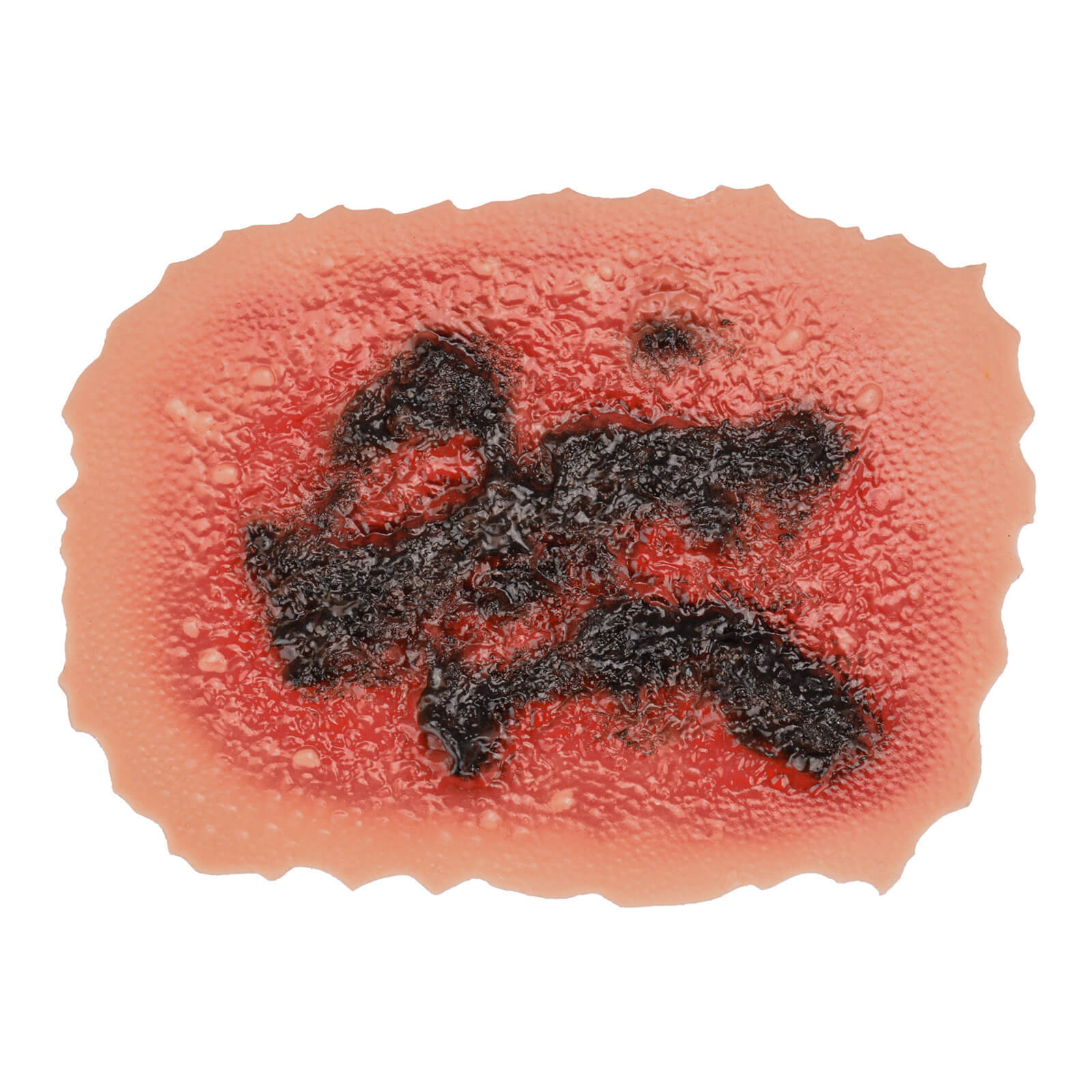 4th Degree Skin Burn Wound Moulage