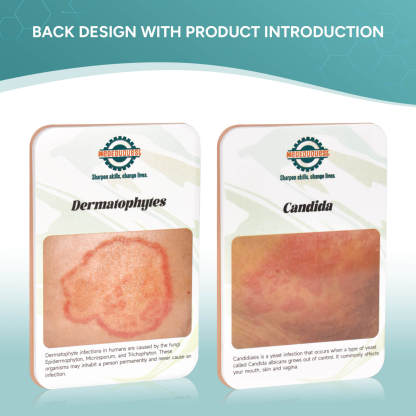 Palm-Sized Fungal Infection Wound Model Set (2 Pieces)