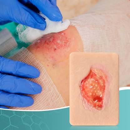 Card-sized Granulation Wound Simulation Models
