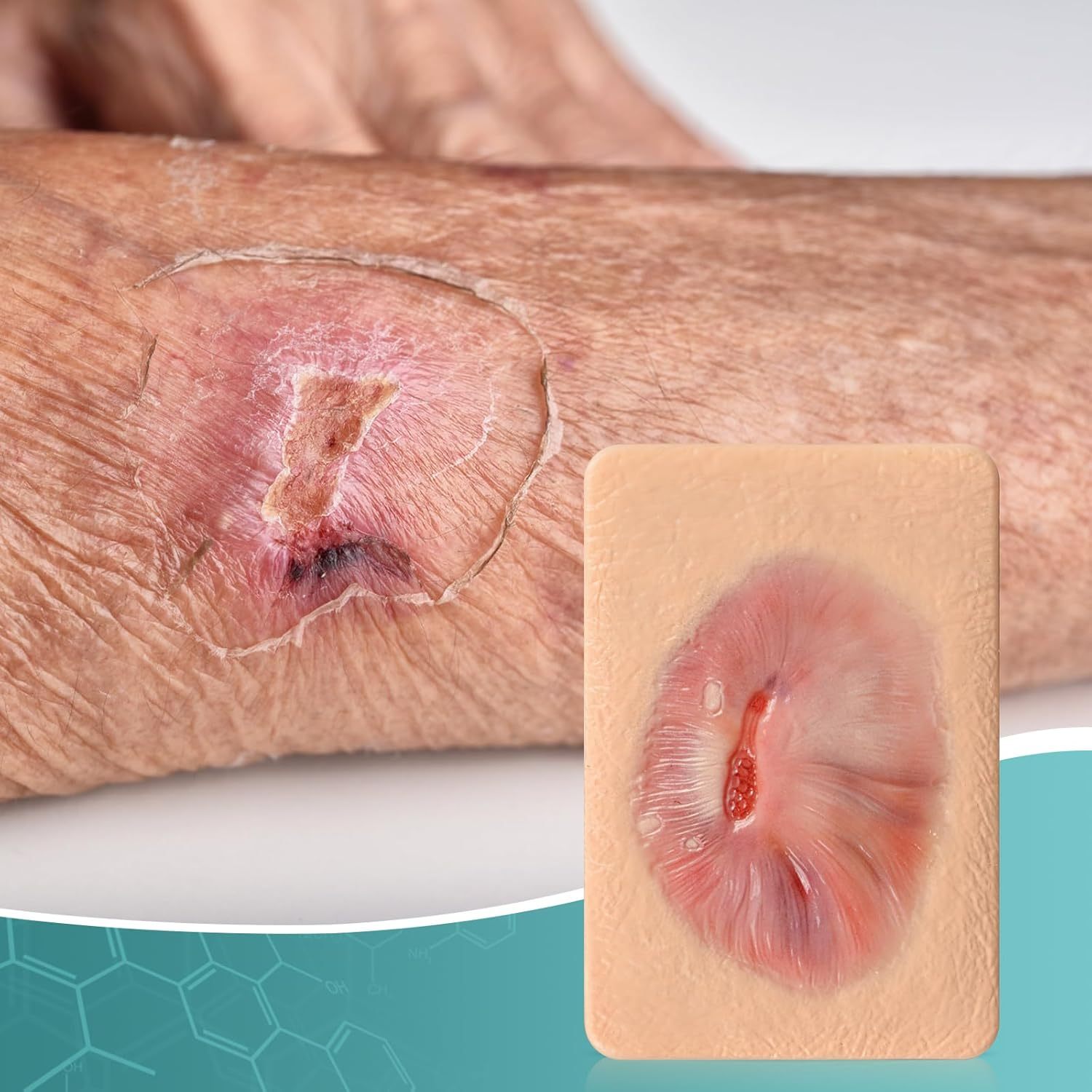 Card-sized Granulation Wound Simulation Models