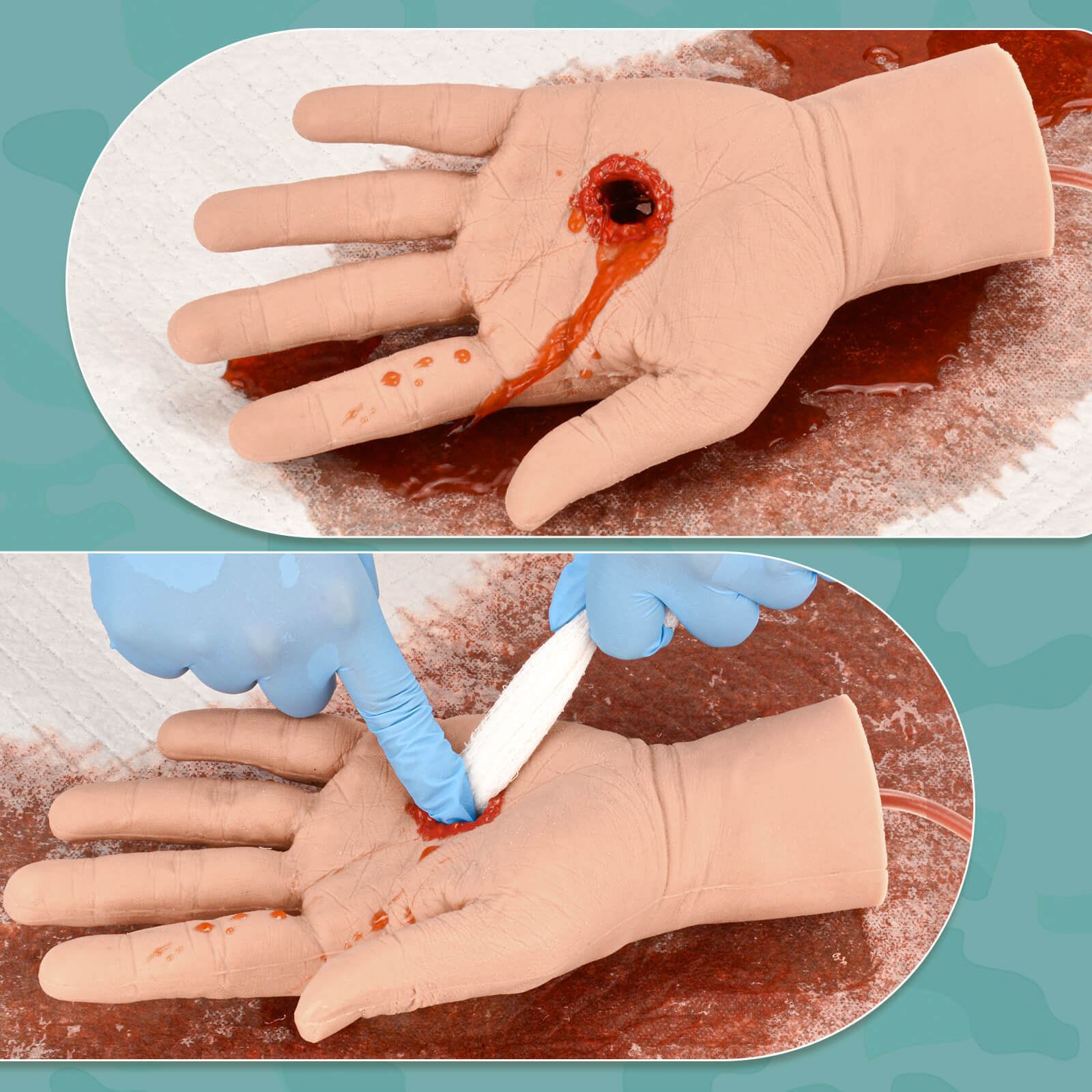 GSW Through Hand Stop The Bleed Training Kit