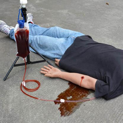 Gunshot Wound Tourniquet Training Arm
