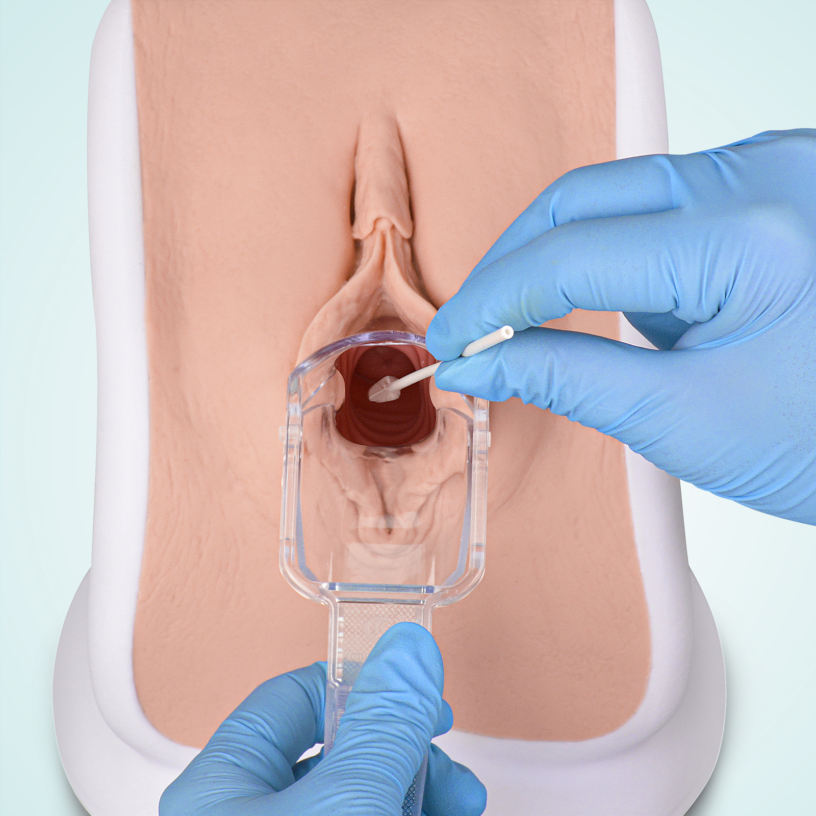 Gynecological Examination Model with 6 Cervical Pathology Replacements