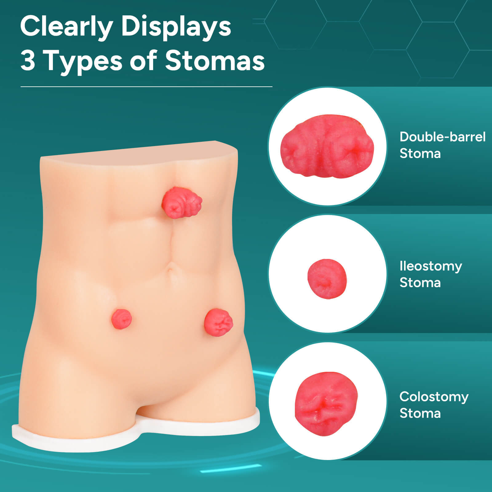 Handheld Stoma Demonstration Model Male and Female Set