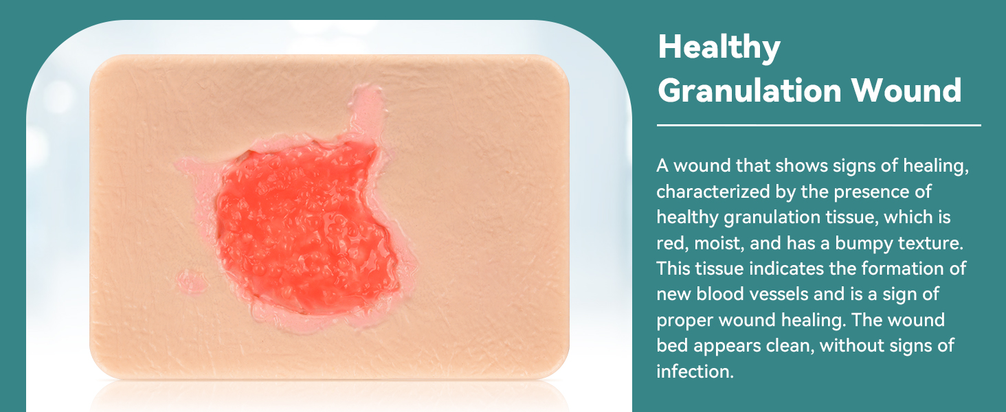 Healthy Grannulation Wound Model