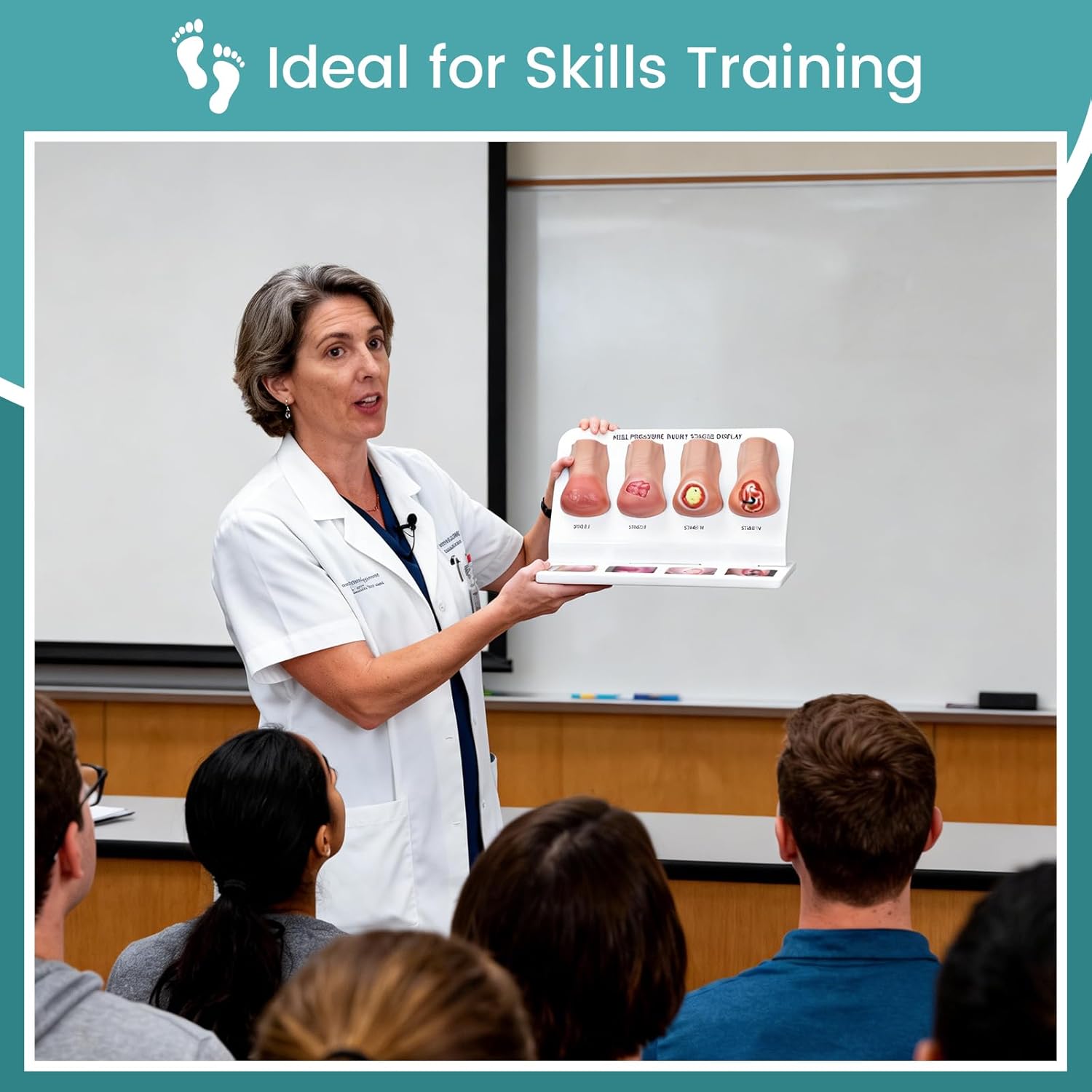 Heel Pressure Injury Stages Demonstration Model (Stage I–IV)
