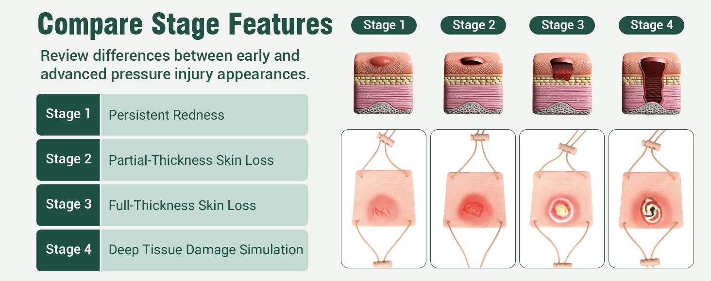 Wearable Heel Ulcer