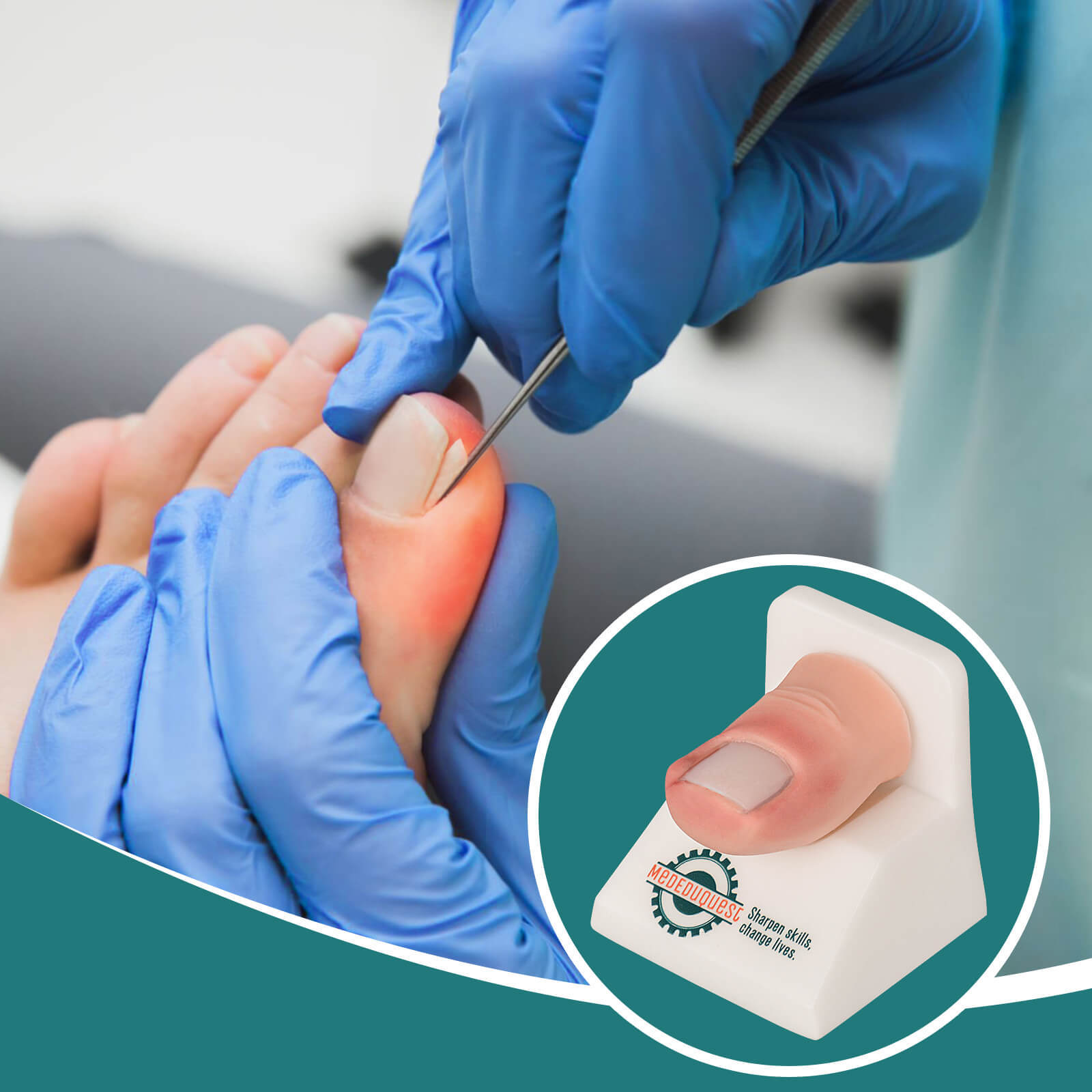 Ingrown Toenail Trainer Kit with Base for Toenail Removal Simulation