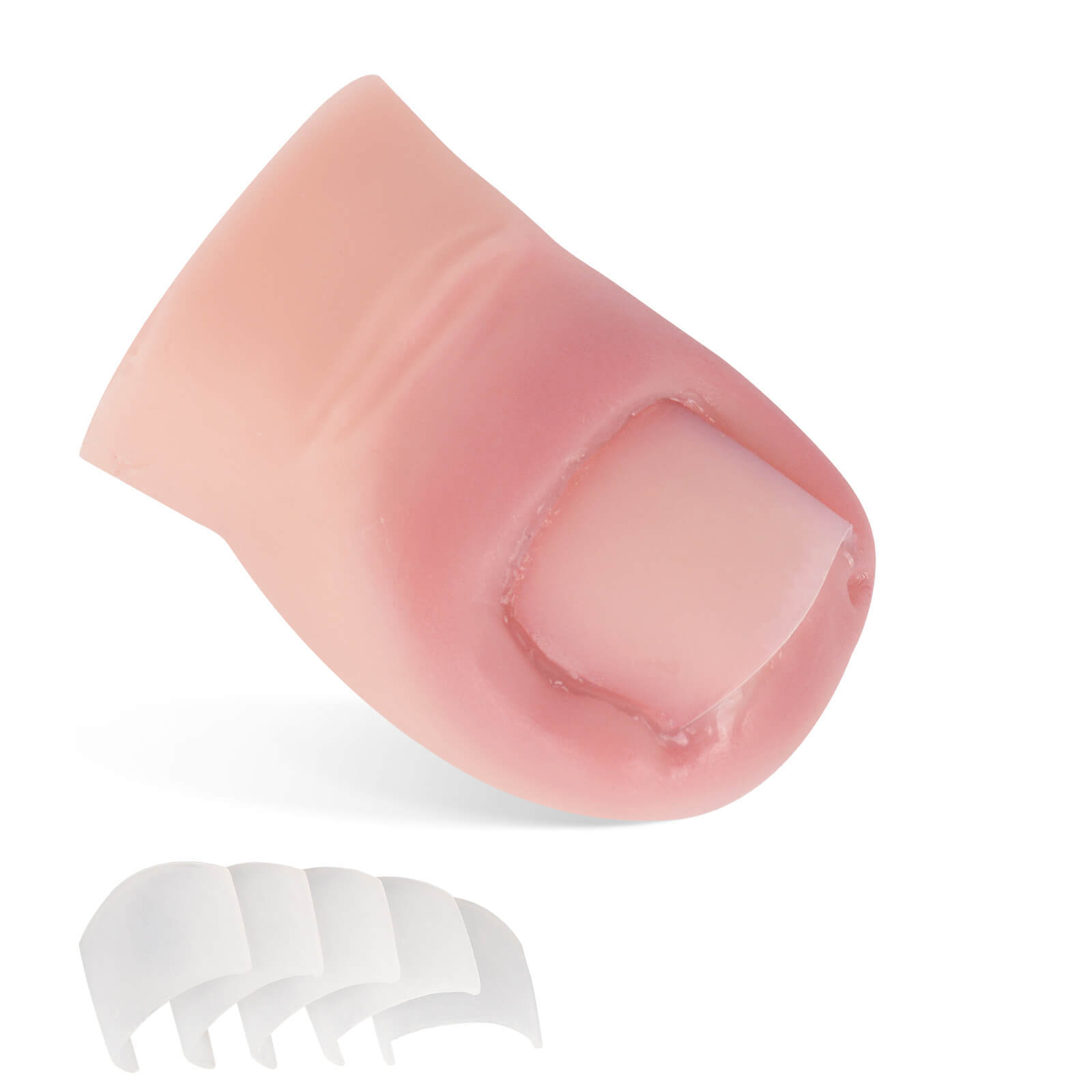 Ingrown Toenail Removal Training Model with Replaceable Toenail