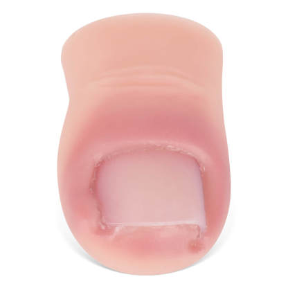 Ingrown Toenail Removal Training Model with Replaceable Toenail
