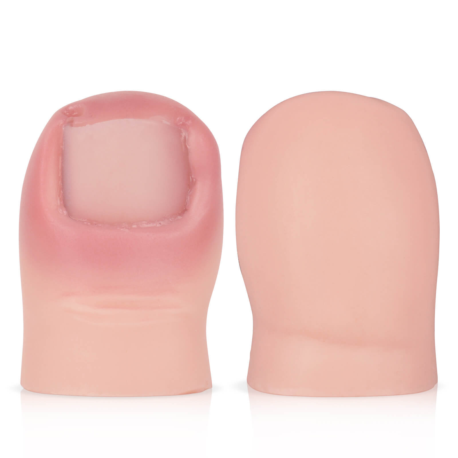 Ingrown Toenail Removal Training Model with Replaceable Toenail
