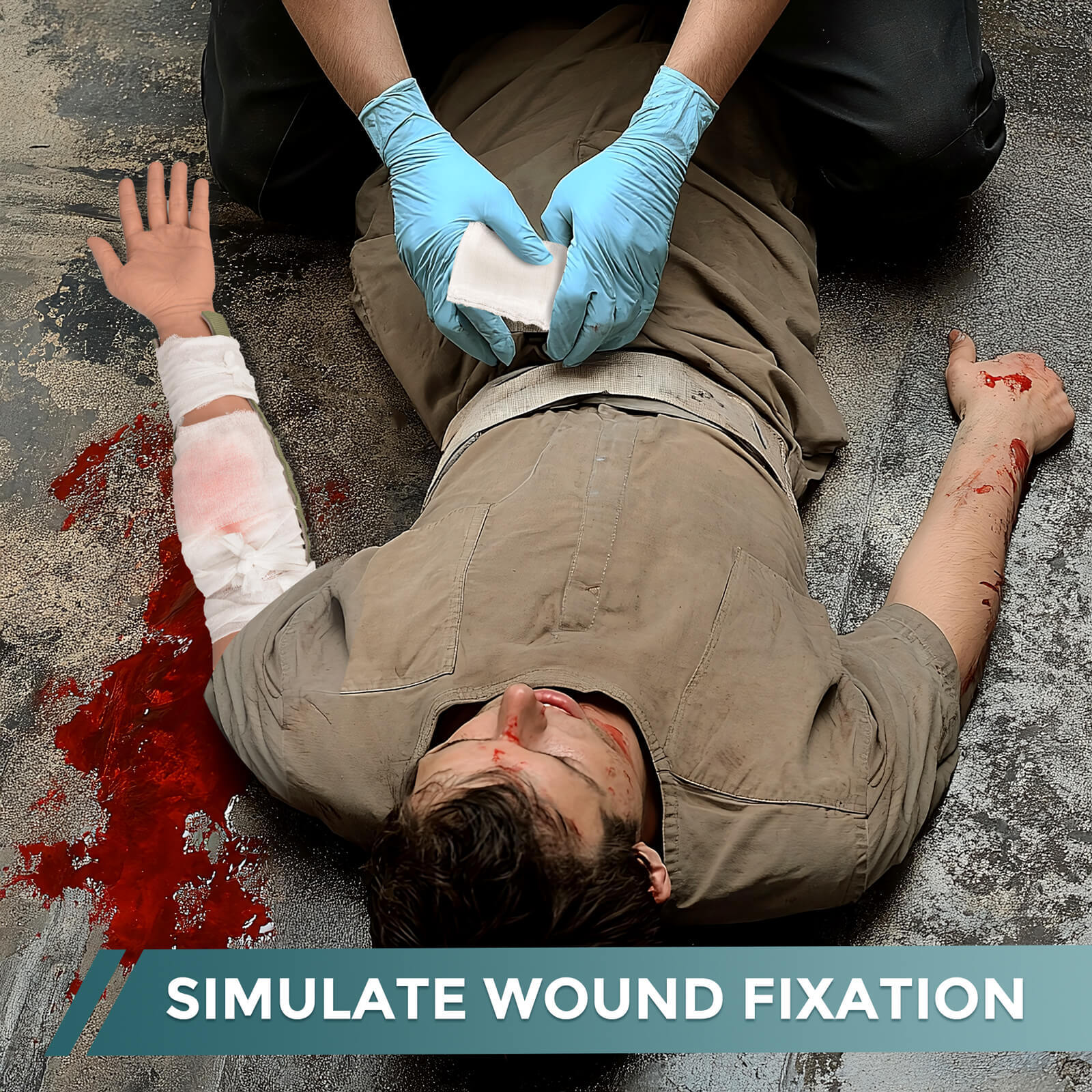 Trauma Arm with Bleeding Laceration Wound