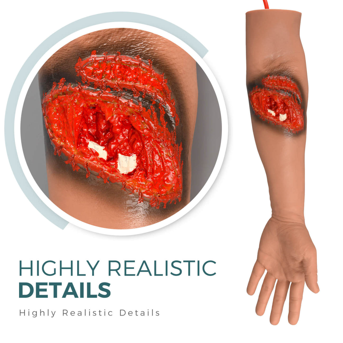 Lacerated Arm and Fractured Training Model