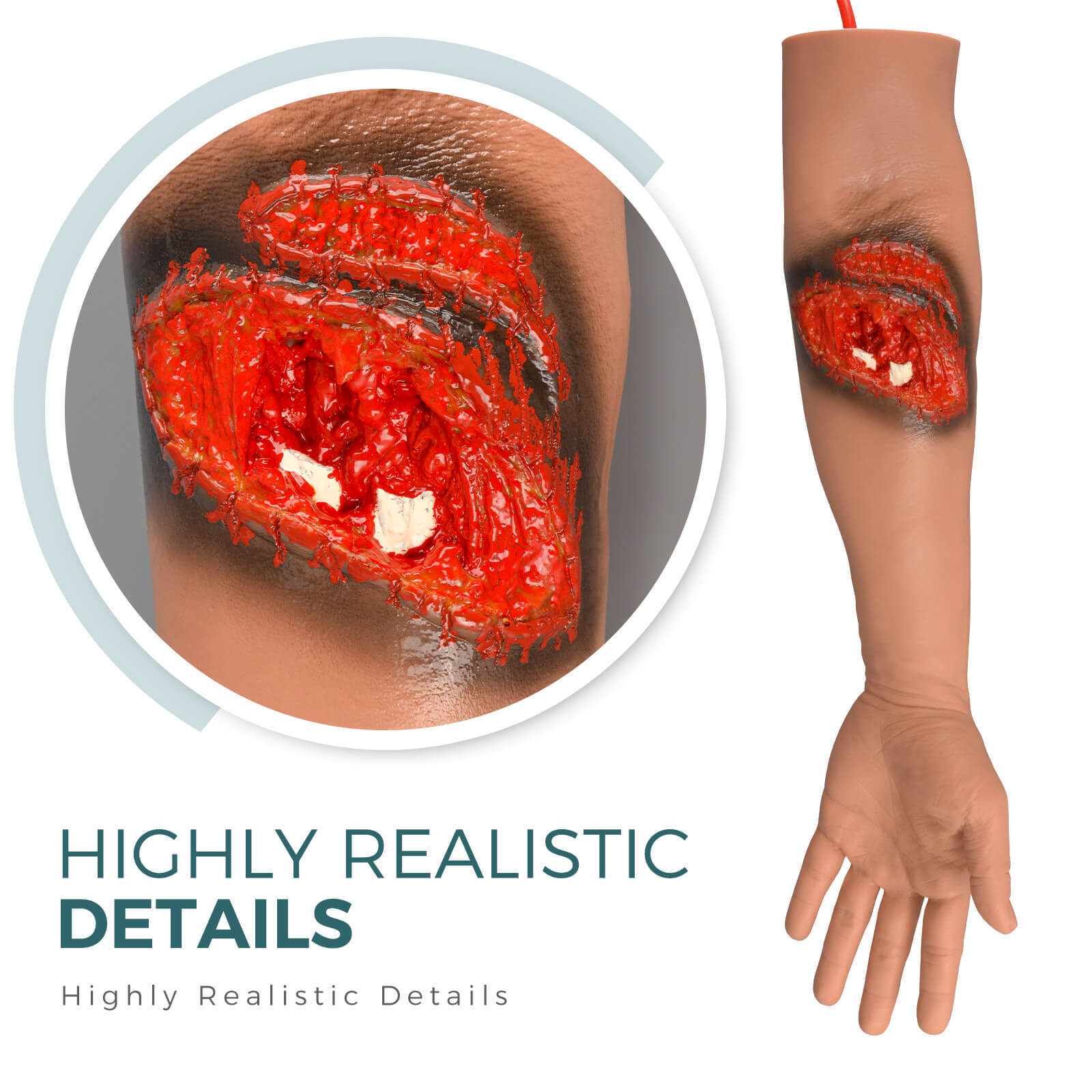Lacerated Arm and Fractured Training Model