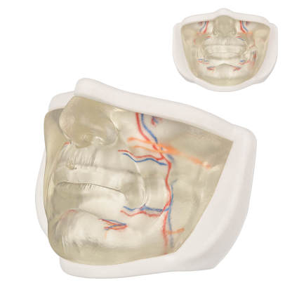 Transparent Lower Facial Injection Training Model with Simulated Blood Vessels