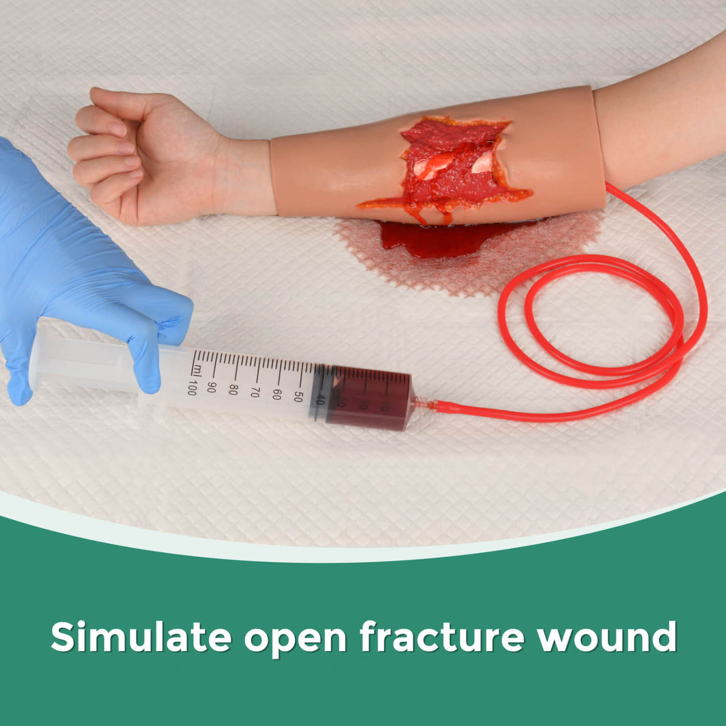 Open Fracture Wound Hand Sleeve Kit with Bleeding Function