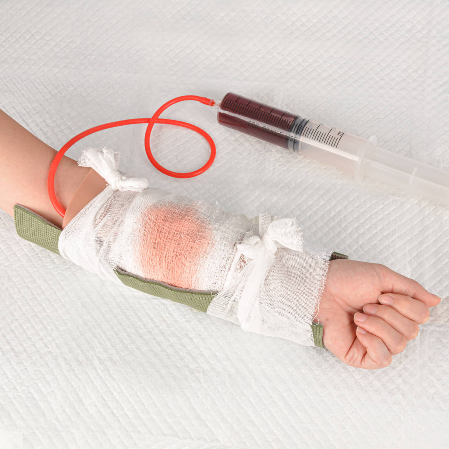 Open Fracture Wound Hand Sleeve Kit with Bleeding Function
