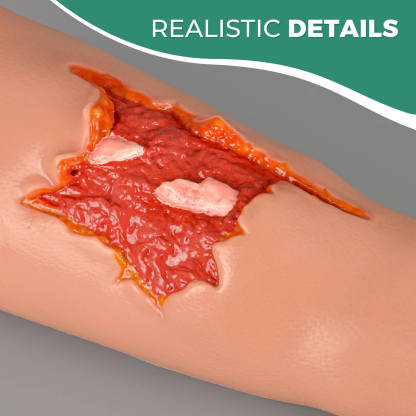 Open Fracture Wound Hand Sleeve Kit with Bleeding Function