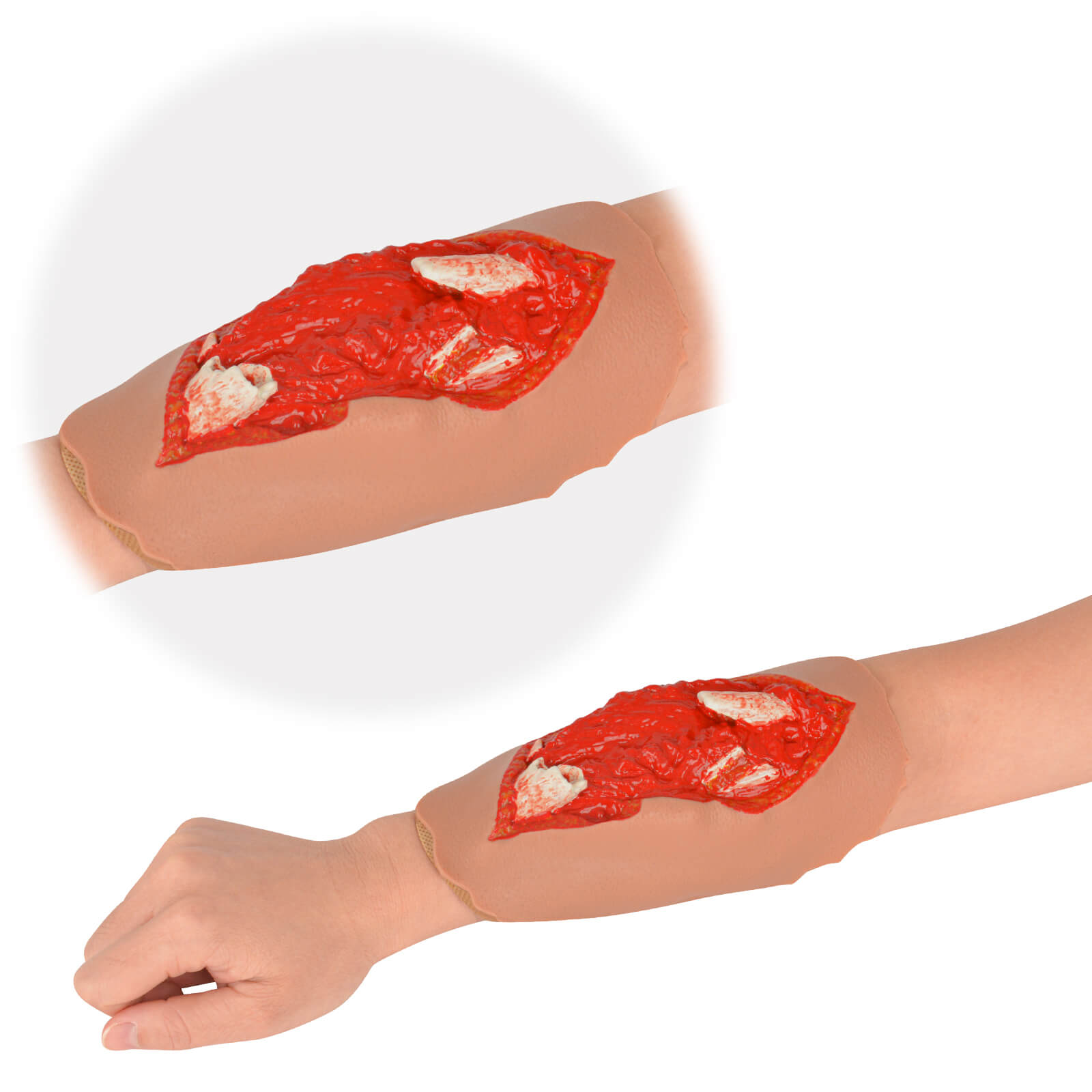 Open Fracture Wound Moulage, Grade 2-5