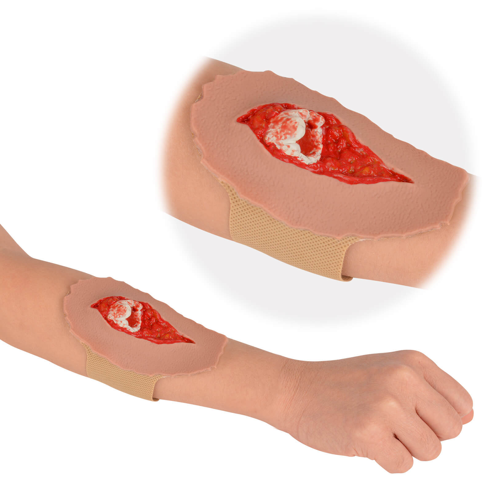 Open Fracture Wound Moulage, Grade 2-5