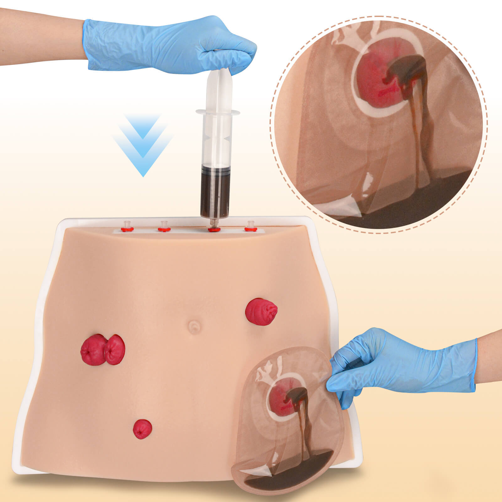 Ostomy Care Simulator with Adjustable Display Bracket